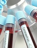 Ukraine reports 3,372 new coronavirus cases