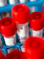 Ukraine reports 5,583 new coronavirus cases