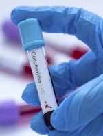 Ukraine reports 3,565 new coronavirus cases