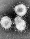 Ukraine reports 1,022 new coronavirus cases in past 24 hours