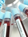 Ukraine reports 483 new coronavirus cases, bringing total to 24,823