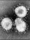 Ukraine confirms 1,319 coronavirus cases