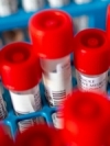 Ukraine reports 6,719 new coronavirus cases