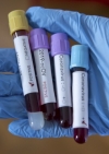 Public Health Center denies fake reports about five cases of coronavirus in Ukraine